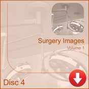 Image of Surgery Images