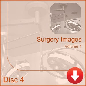 Image of Surgery Images
