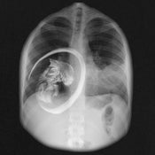 Image of 'BAD CHEST'