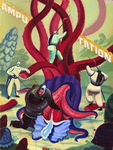 Image of "Amputation"