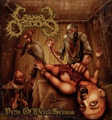 Image of NEW!!! CRANIAL OSTEOTOMY - Victim Of Wicked Sickness CD 