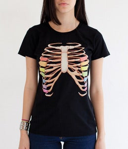 Image of Xylobones