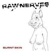 Image of Raw Nerves - Burnt Skin EP