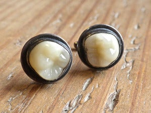 Image of MOLAR cufflinks
