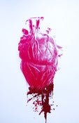 Image of "Bleeding Heart" Pop Surrealism Glitter Screen Print Anatomical Lowbrow Valentines Art 