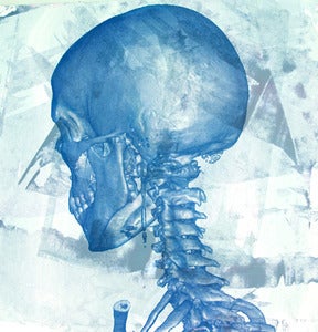 Image of "Studies of a Skull"-left 120 degree View, LIMITED EDITION Screen Print Anatomical Lowbrow Art, C.T