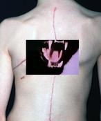 Image of Breathing Problem - Reactive Attachment Disorder c-60