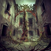 Image of Birth Asphyxia - Human Obelisk