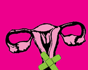 Image of cervical cancer painting