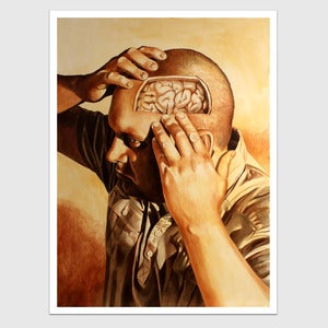 Image of Removal of Portion of Skull to Reveal Brain by Billy Reynolds