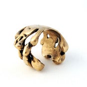 Image of drip matrix ring